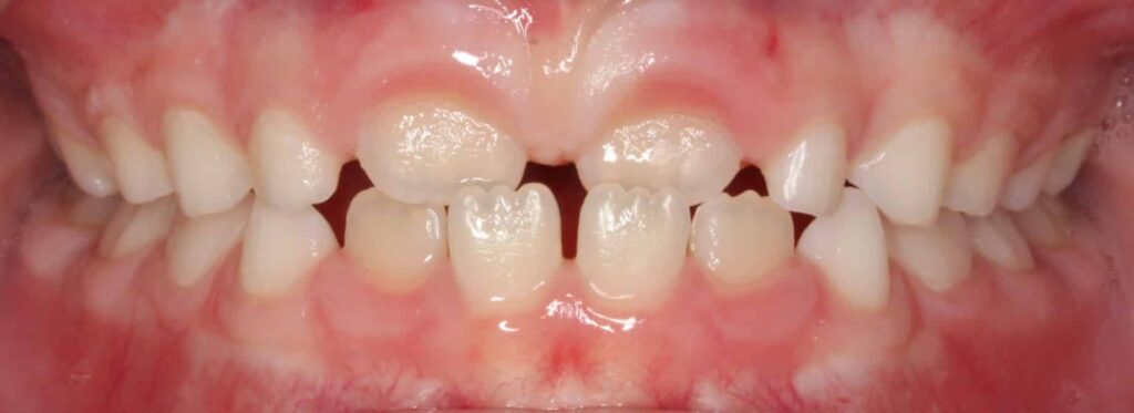 Crossbite Together Pediatric Dentistry & Orthodontics in Annandale, VA