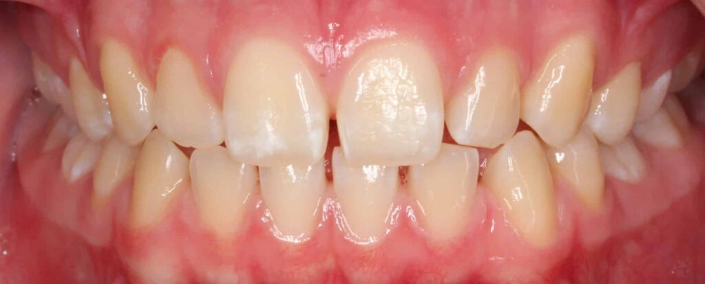 Spacing Together Pediatric Dentistry & Orthodontics in Annandale, VA